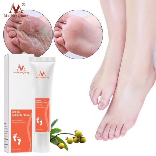 best athletes foot cream UK