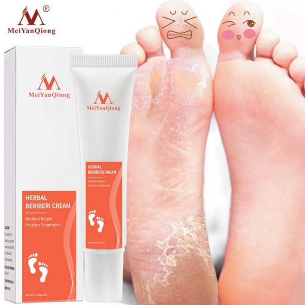 Best Quick effect athletes foot cream UK