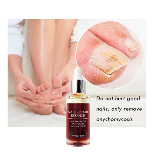 best athelets foot repair cream UK