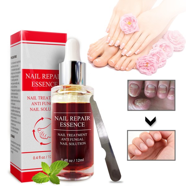 best athletes foot cream antifungal cream