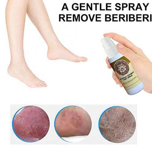 Quick Anti Fungal Combat Foot Spray