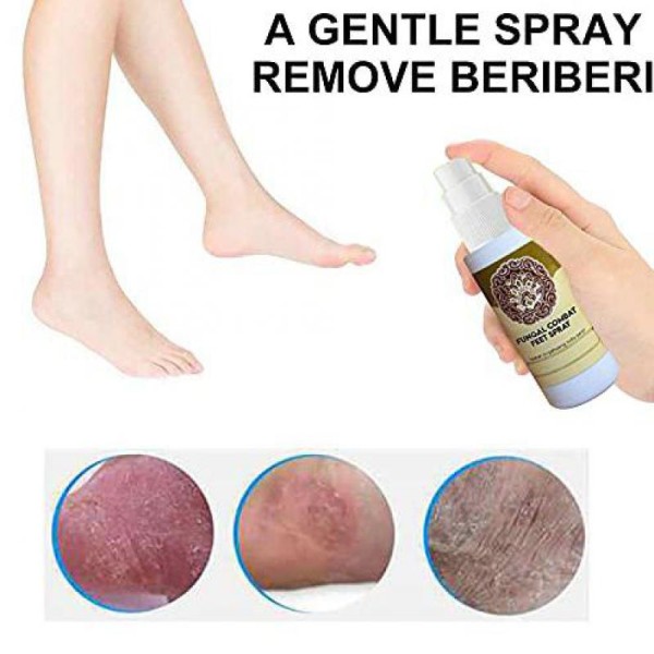 Quick Anti Fungal Combat Foot Spray