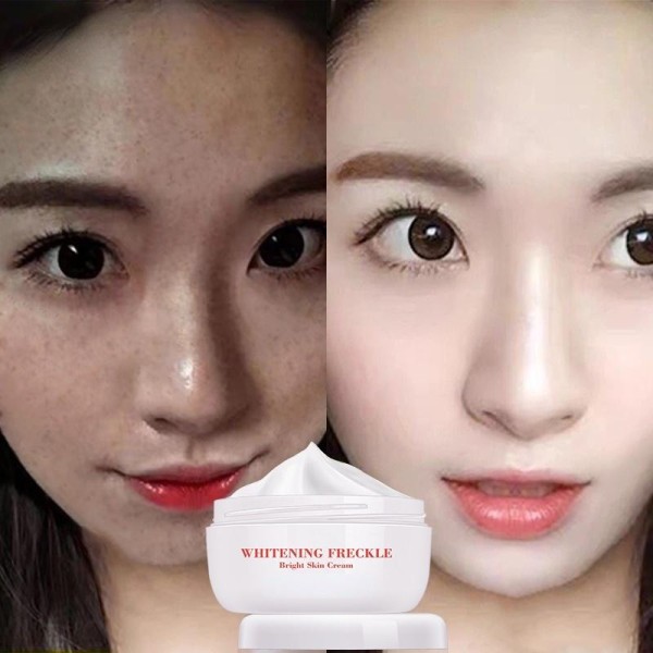 Powerful Whitening Freckle Cream Remove Melasma Acne Spots Pigment