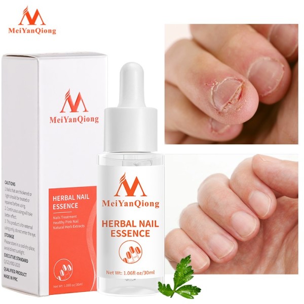 Nail Repair Essence Serum
