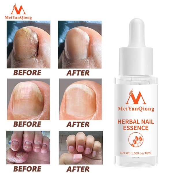 Nail Repair Essence Serum