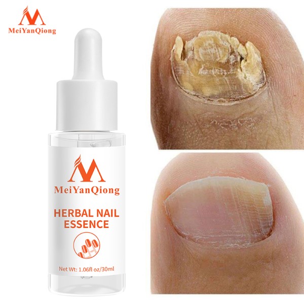 Nail Repair Essence Serum