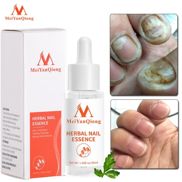 Nail Repair Essence Serum