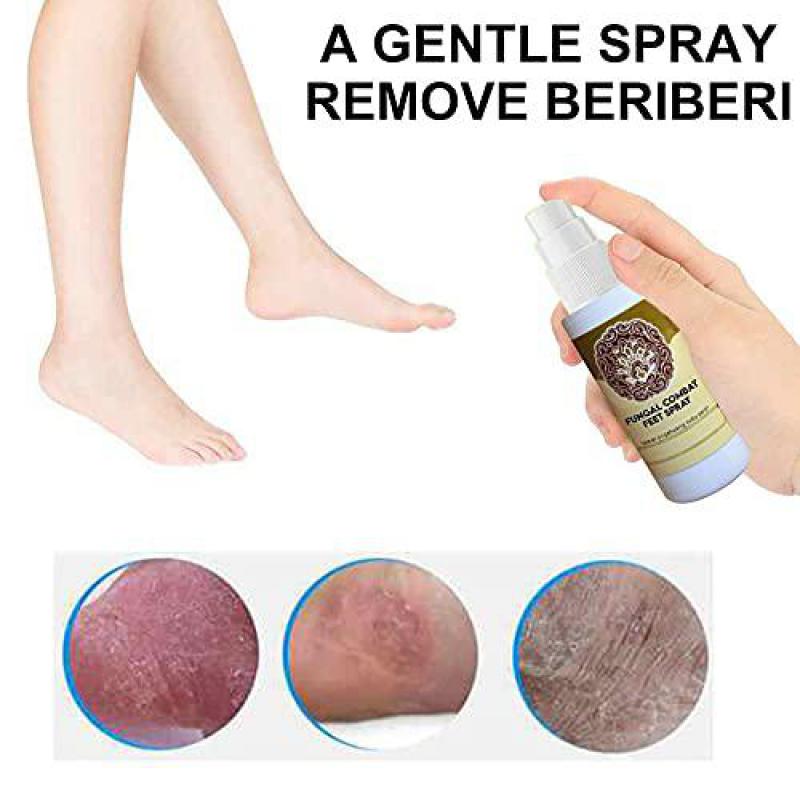 Quick Anti Fungal Combat Foot Spray