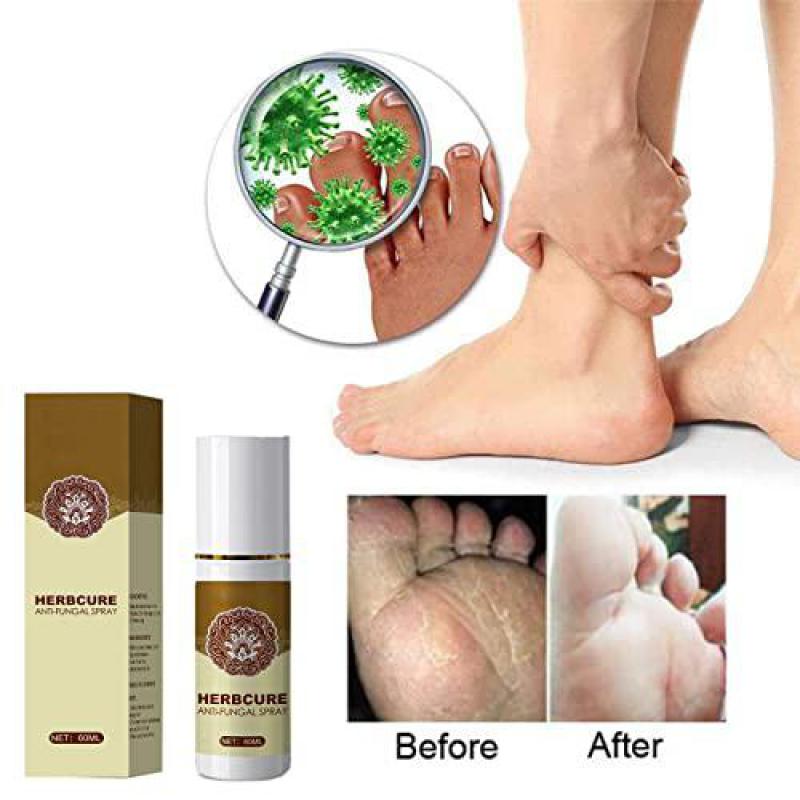 Best Anti Fungal Combat Foot Spray