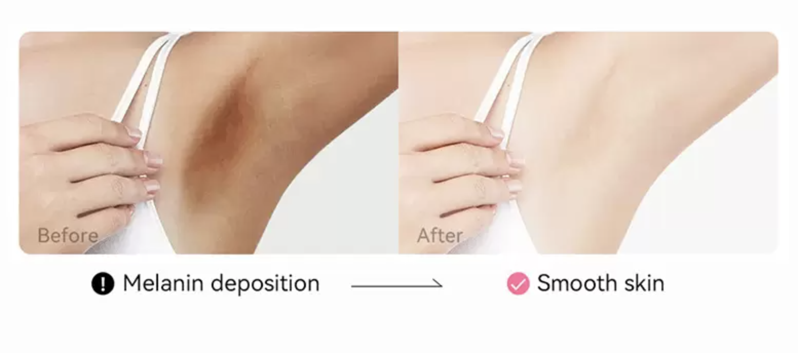 armpit whitening cream uk free shipping before after