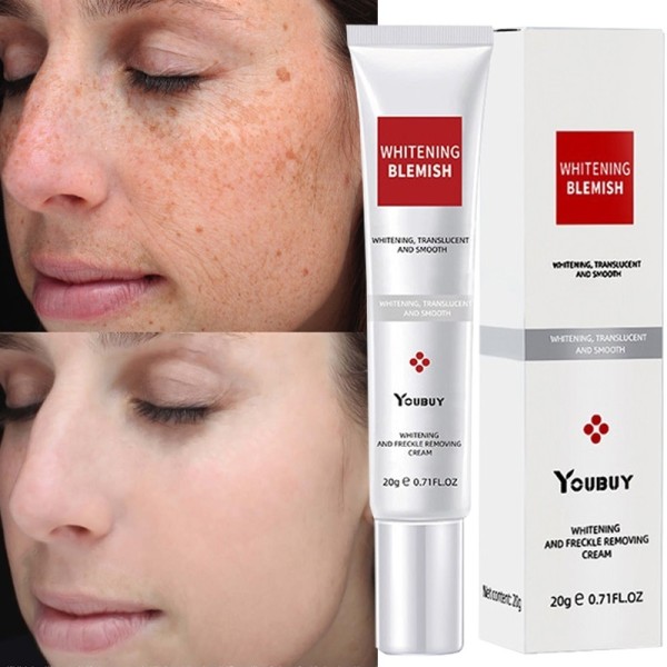 Effective Whitening Freckle Cream Melasma Dark Spots Melanin Removal