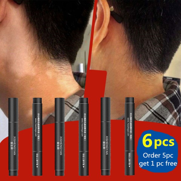 Waterproof Camouflage Vitiligo Makeup Covering Concealer Pen Long Lasting
