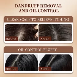 Oil Control Sandalwood Anti-Dandruff Shampoo with Zinc Pyrithione