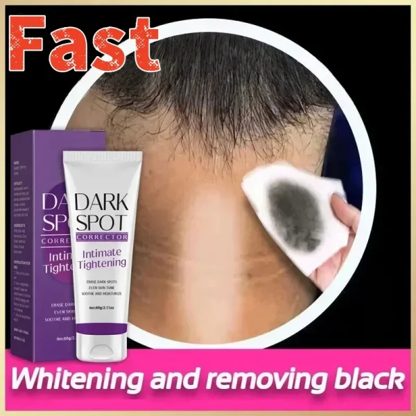 Nicotinamide Brightening Cream for Dark Skin